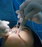 ד"ר גל אבישי: עקירות, השתלות שיניים וטיפול באבנים בבלוטות הרוק -תמונה